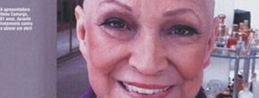 Revista publica foto de Hebe Camargo careca durante luta contra câncer