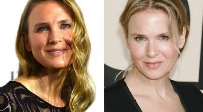 Renée Zellweger aparece irreconhecível; cirurgiões comentam a mudança