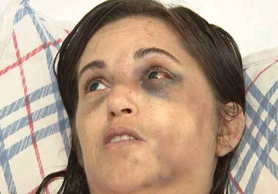 Polícia prende suspeito de agredir mulher dentro de hospital
