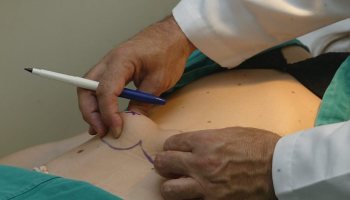 Clínicas sem UTI não poderão mais realizar cirurgia plástica