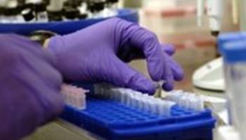 Gel reduz em 39% risco de pegar Aids em mulheres