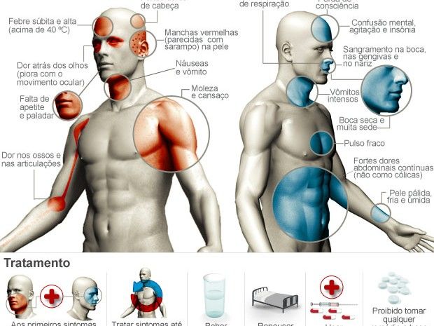 Dengue sintomas (Foto: Arte/G1)