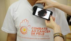 O Dia Nacional de Combate ao Câncer de Pele é lembrado em 26 de novembroArquivo/Agência Brasil/Fernando Frazão