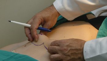 Mitos e verdades sobre a cirurgia plástica