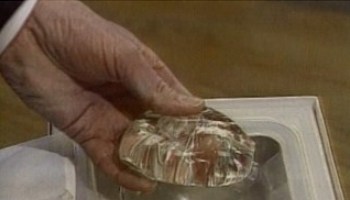 ‘Mamografia é mais dolorosa para quem tem silicone’, alerta médica