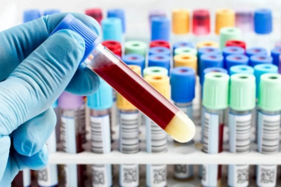 Coletas de exames laboratoriais serão realizadas na zona rural de Andradina